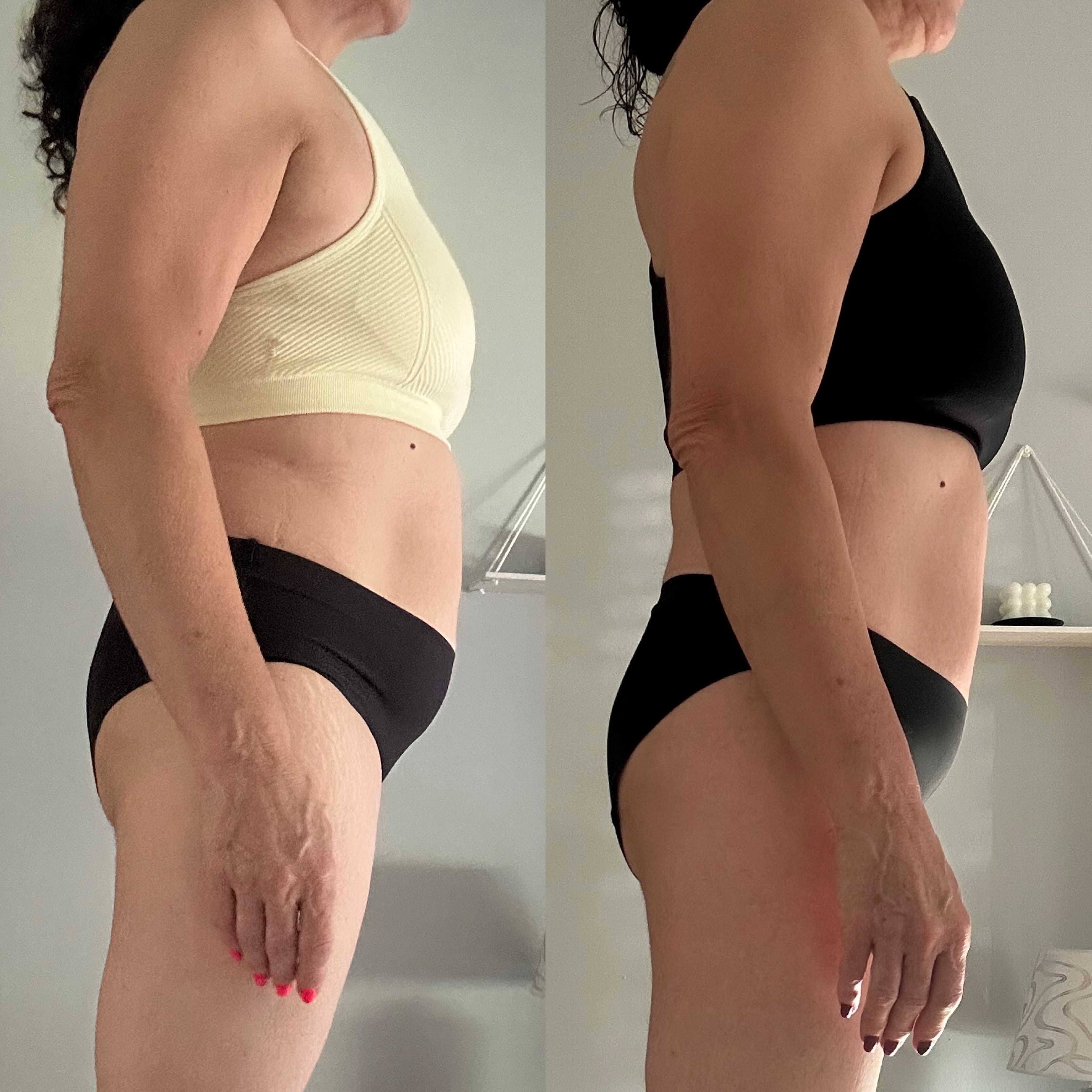 Transformación de Pilar, antes y después de perfil